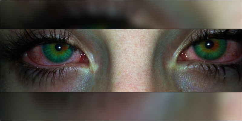 Smoking Effects On Eyes