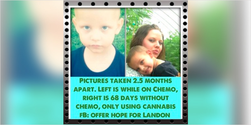 Oil Cures 3 Year Old 2 Watch: Cannabis Oil Cures Boy Given 48 Hours To Live