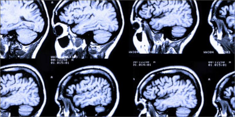 scan New Study Reveals How CBD Can Help People Quit Cigarettes