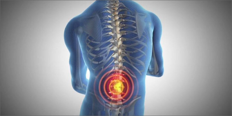 cannabis vs lupus prescription back pain Cannabis vs. Lupus