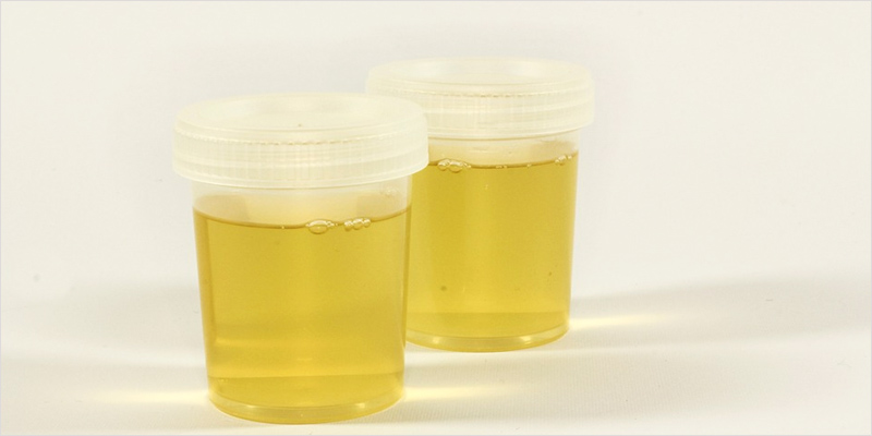 Cannabis Blood Testing 2 The Truth About Cannabis Blood Testing You Need To Know