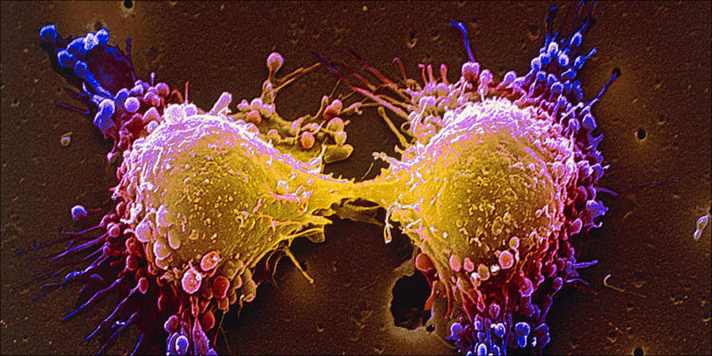 4 Ways Cannabis Kills 1 These Are The 4 Ways Cannabis Kills Cancer