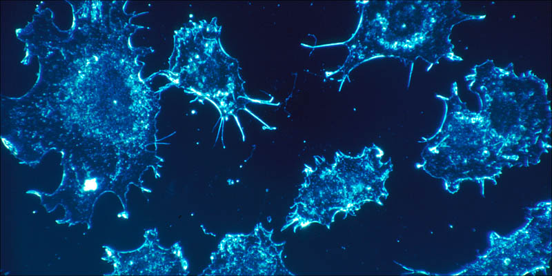 4 Ways Cannabis Kills 2 These Are The 4 Ways Cannabis Kills Cancer