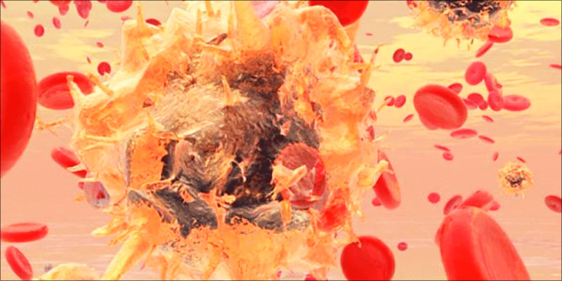 4 Ways Cannabis Kills 4 These Are The 4 Ways Cannabis Kills Cancer