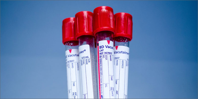 5 cannabis diabetes vacutainer Does Cannabis Help With Diabetes Treatment?