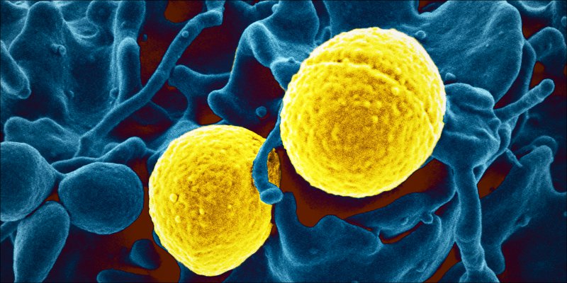 Autoimmune Disease 3 Autoimmune Diseases: How Does Cannabis Help?