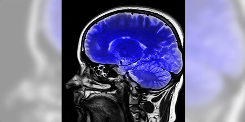1 does cannabis heal concussions Does Cannabis Heal The Brain After A Concussion?