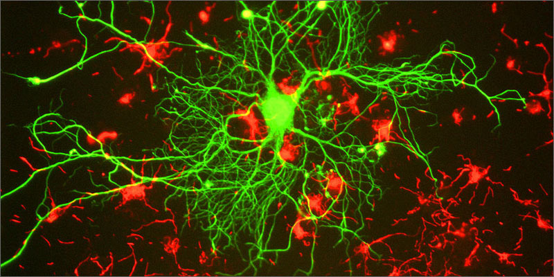 2 does cannabis heal concussions Does Cannabis Heal The Brain After A Concussion?
