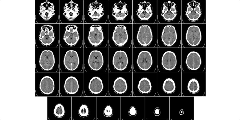 3 does cannabis heal concussions Does Cannabis Heal The Brain After A Concussion?