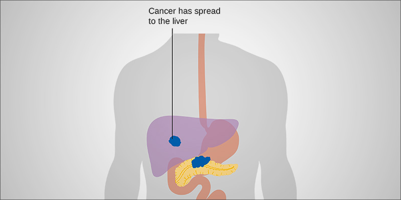 5 Things You 2 2 photo 5 Things You 2 2 5 Surprising Things You Didn’t Know About Cannabis And Cancer