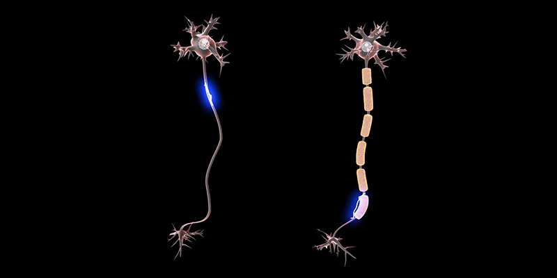 Cannabis Company Designs 1 Cannabis Company Designs Pain Patch For Fibromyalgia And Nerve Pain