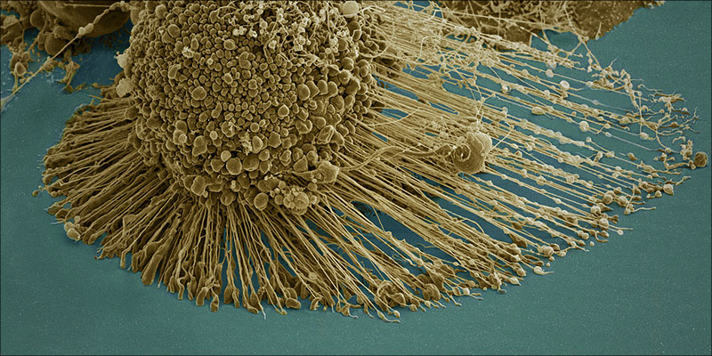 Does Weed Cure 3 Does Cannabis Cure Cancer?