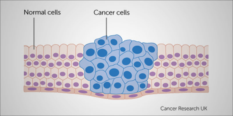 Does Weed Cure 4 Does Cannabis Cure Cancer?