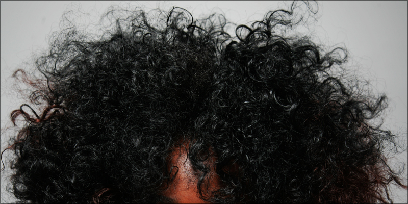 Hair Follicle Test 9 photo Hair Follicle Test 9 How Can I Pass A Hair Follicle Test?