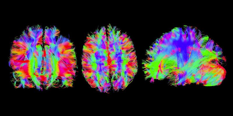 brain