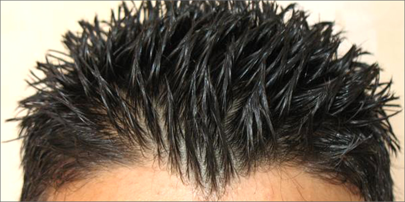 test4 How Can I Pass A Hair Follicle Test?