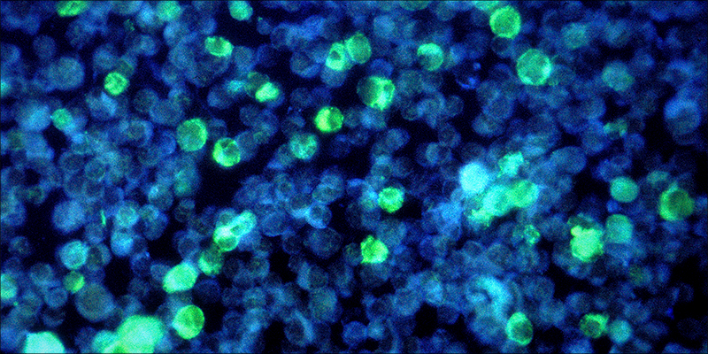 Is Cannabis Effective 4 Is Cannabis Effective Against Leukemia?