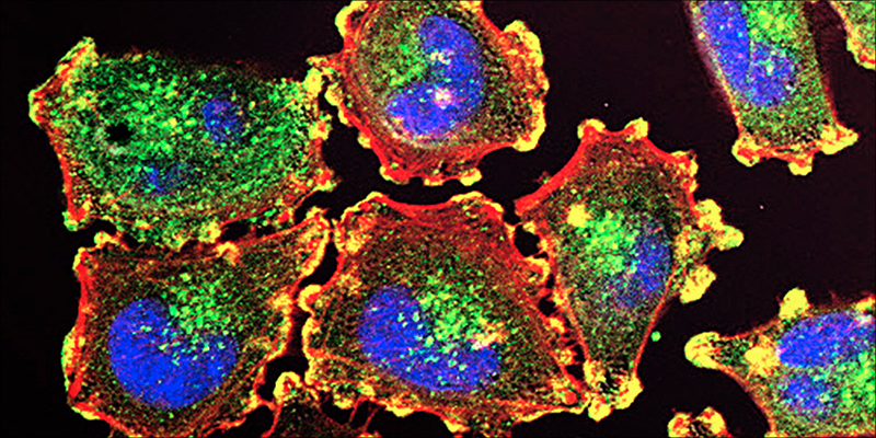 Marijuana And Cancer 10 10 Powerful Ways Cannabis Can Benefit Cancer Patients