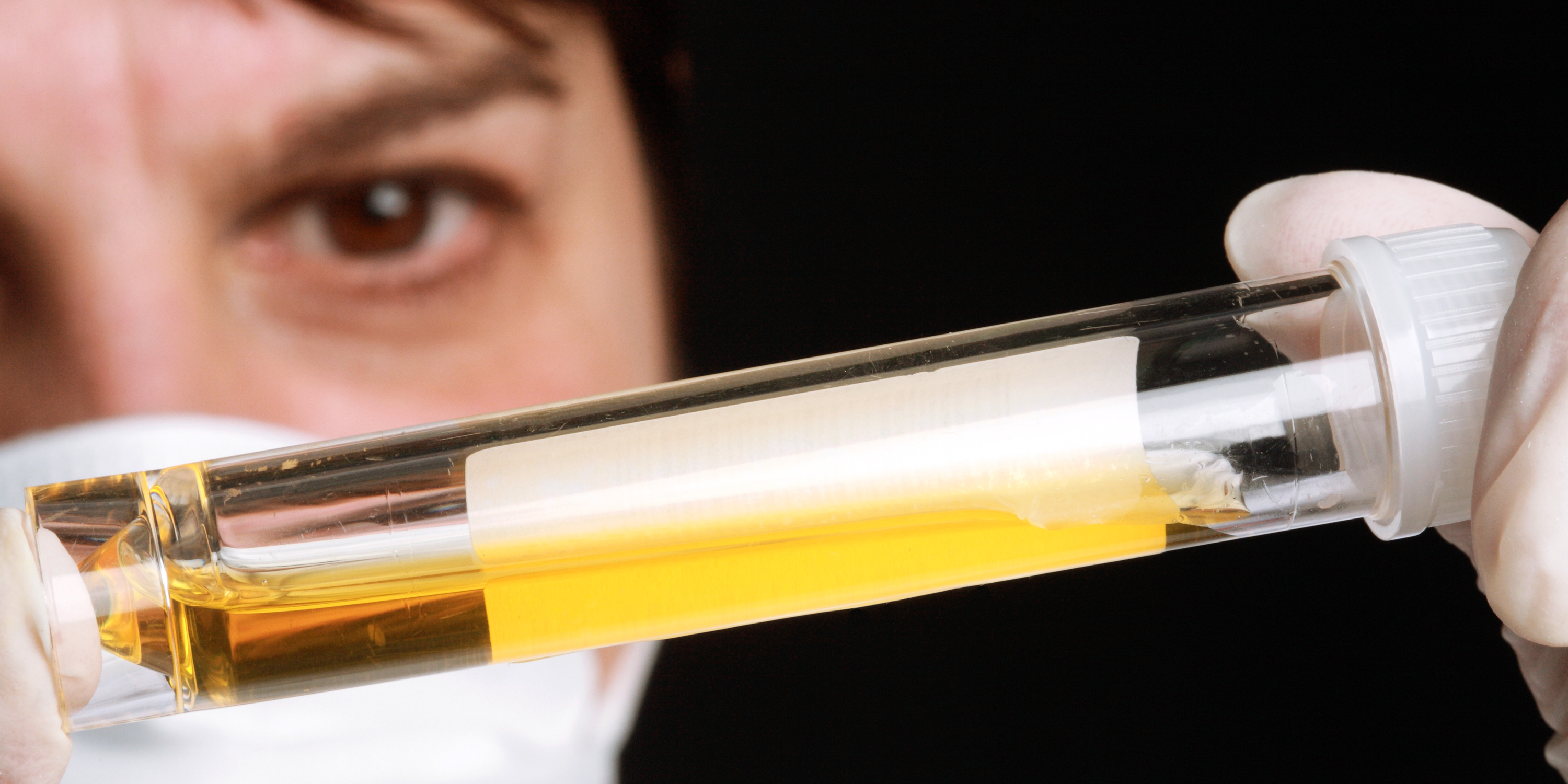 How Long Does Weed Stay In Your Urine