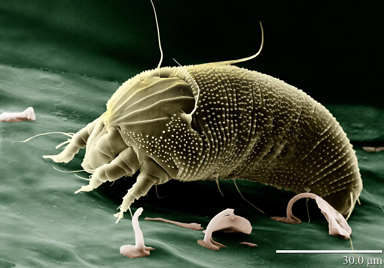 hemp russet mite 4 of 5 The invisible pest thats destroying cannabis crops