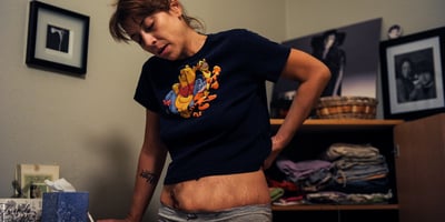 Is Cannabinoid Hyperemesis Syndrome Real? Is Cannabinoid Hyperemesis Syndrome Real?